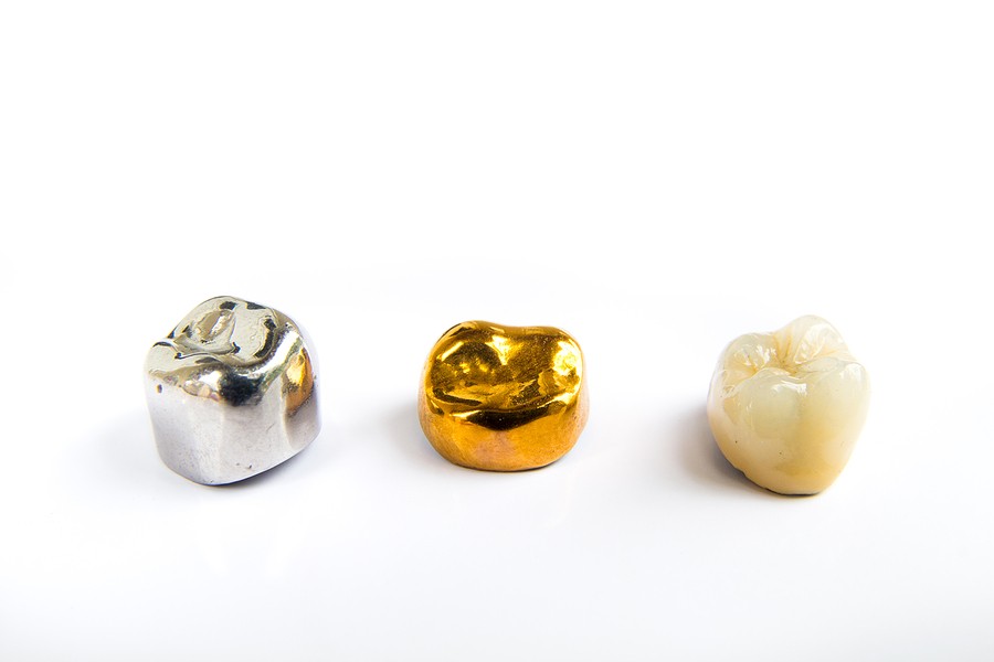 Different types of dental crows last longer.
